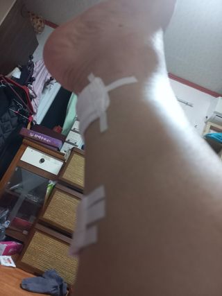 이정민님의 고추 · 병해충상담 작성글 사진