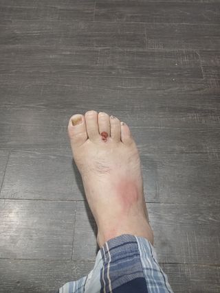 자기왕사랑해님의 고추 · 영농일지 작성글 사진