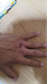 서초농원님의 작성글 사진