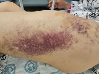 흰돌농원님의 기타작물 · 영농일지 작성글 사진