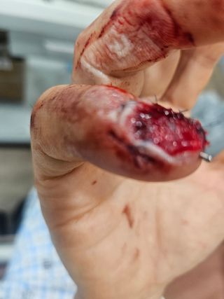 권상탁님의 마늘 · 영농일지 작성글 사진