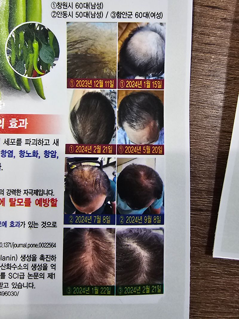 한농농약종묘사님의 장터 판매 상품 [머리카락 나는 고추[발모고추씨앗] 10립] 첨부 사진