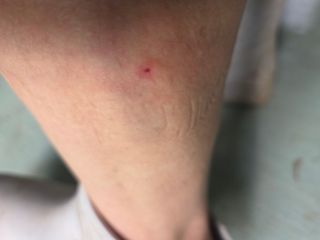이상애초보농업님의 자유주제 · 자유게시판 작성글 사진