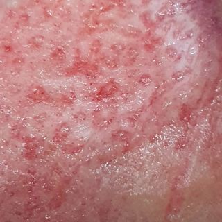 신용돈님의 복숭아 · 자유게시판 작성글 사진