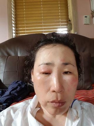 대운이네농원님의 3월 내 작물 자랑하기 · 참여글 작성글 사진