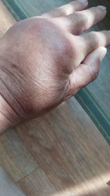 팜모닝 자유주제·자유게시판 게시글 이미지