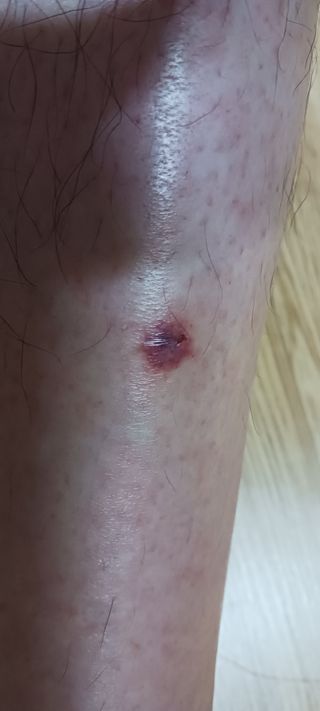 골드핑거님의 자유주제 · 자유게시판 작성글 사진