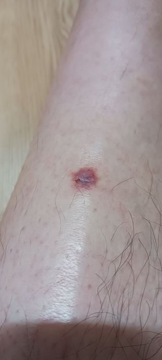 골드핑거님의 자유주제 · 자유게시판 작성글 사진