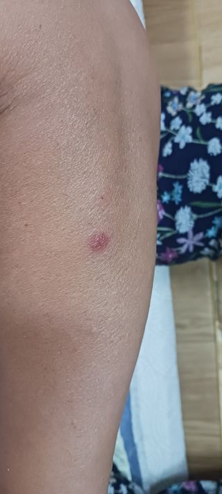 골드핑거님의 자유주제 · 자유게시판 작성글 사진