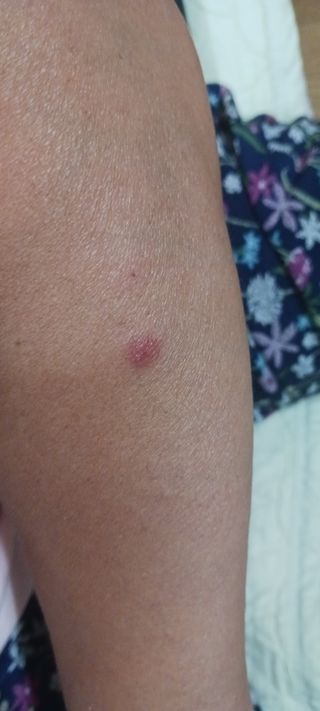 골드핑거님의 자유주제 · 자유게시판 작성글 사진