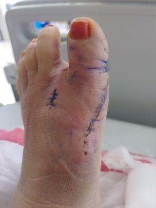 농부.금리나님의 기타작물 · 영농일지 작성글 사진