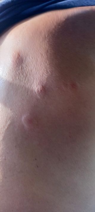 보령 게으른농부님의 자유주제 · 자유게시판 작성글 사진