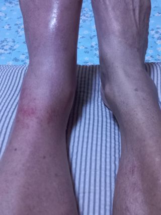 농민님의 상추 · 영농일지 작성글 사진