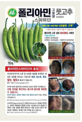 주주씨앗님의 자유주제 · 자유게시판 작성글 사진