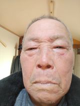 팜모닝 기타작물·병해충상담 게시글 이미지