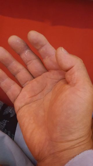 박¿일님의 최고의 제초제는 무엇인가요? · 참여 작성글 사진